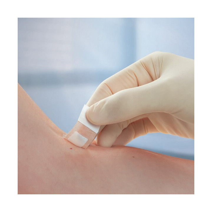BSN Leukoplast® Soft Pflasterstrips Anwendung