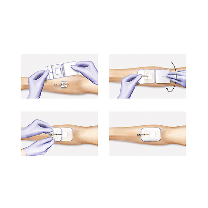 Hartmann Cosmopor® I.V. Kanülenfixierverband Anleitung